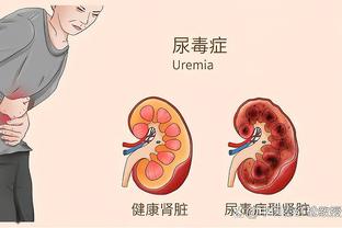 世体：巴萨明夏首要任务之一是留下坎塞洛，曼城标价约3000万欧